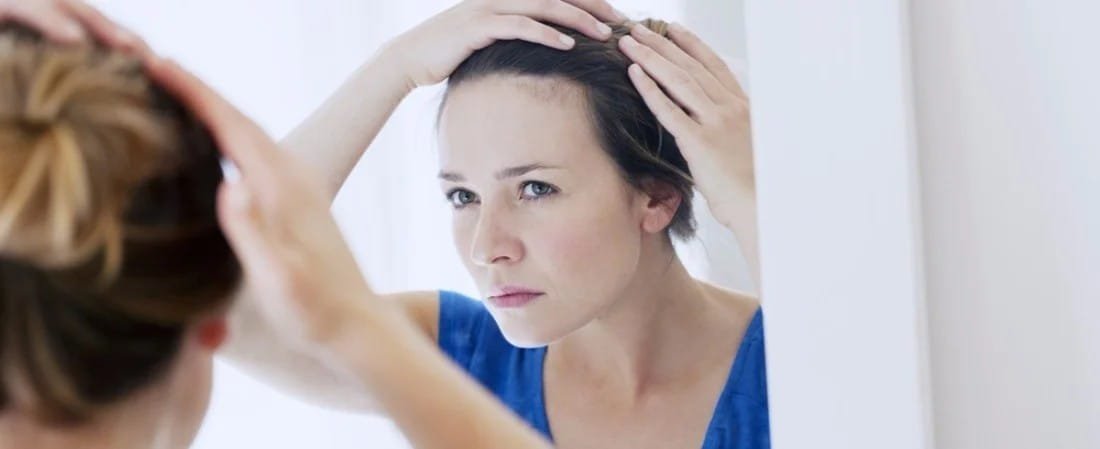 Woman applying cream for seborrheic dermatitis on face