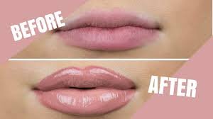 Before and after results showing how to get beautiful lips naturally at home
