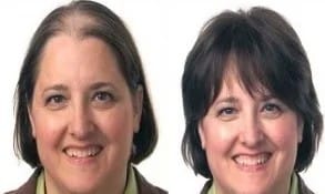 Before and after results showing improvement after reducing hair loss in the shower