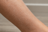 What Causes Dry Skin on the Legs? 12 Causes & Fixes