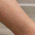 Skin Tips for Clear Skin: 10 Easy Steps for a Healthier, Clearer Complexion